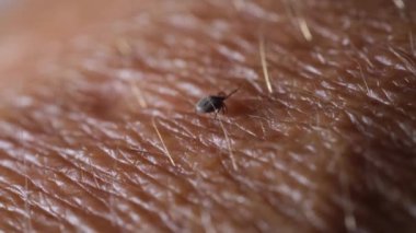 Deride kene kaynaklı beyin iltihabı ya da Lyme hastalığı gibi tehlikeli hastalıklara yol açan bir kene..