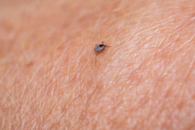 Deride kene kaynaklı beyin iltihabı ya da Lyme hastalığı gibi tehlikeli hastalıklara yol açan bir kene..