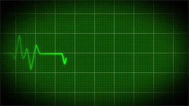 Kalp atışı monitörde. EKG nabız çizgisi. Elektrokardiyogram yeşil ekranda. Döngülü canlandırma