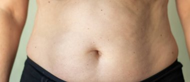 Bir insanın göbek deliğinin, cilt detaylarını ve kırışıklıklarını gösteren odaklanmış görüntüsü