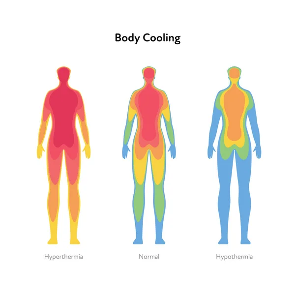 Hyperthermie Und Unterkühlung Gesundheitsinformationsgrafik Vektorflache Darstellung Des Gesundheitswesens Körperkühlung Infrarot — Stockvektor