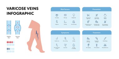 Sağlık bilgileri için varisli vasküler hastalık. Vektör ana hatları simgesi çizimi. Risk faktörü, önleme, semptomlar, DVT tedavisi. Cinsiyet olasılığı. Sağlık ve eğitim için tasarım