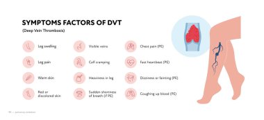 Sağlık bilgileri için derin ven trombozu. Vektör ana hatları simgesi çizimi. DVT belirtileri. Kan damarlarında zonklayan kadın bacağı. Sağlık ve eğitim için tasarım