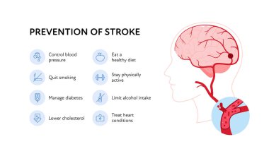 Sağlık bilgileri için beyin nöral hastalıkları. Vektör düz çizim. Felç posteri ve ikon setinin önlenmesi. Sağlık hizmetleri için tasarım