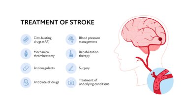 Sağlık bilgileri için beyin nöral hastalıkları. Vektör düz çizim. Felç posteri ve ikon seti tedavisi. Sağlık hizmetleri için tasarım
