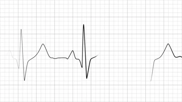 Dynamic heart rate or heart beat line. Cardiogram signal. Monochrome, black and white colors. Patient\'s vital signs. Pulse measuring. Medical. 3D rendering