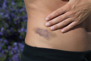 İnsan vücudundaki büyük çürüklerin ayrıntıları.