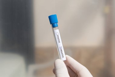 Test tüplü bir laboratuvar teknisyeninin yumuşak odaklı elleri. Olumsuz sonuç.