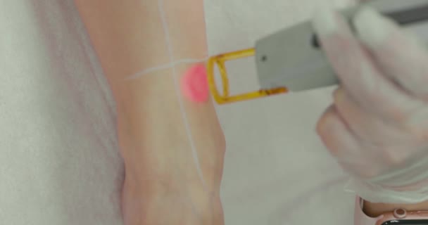 Close Footage Female Client Leg Receiving Pulses Laser Light Destroying — 비디오