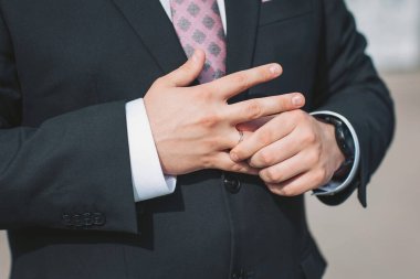 Bulanık bir arkaplanda evlilik yüzüğünü çıkaran adam, yakın plan. Boşanma kavramı