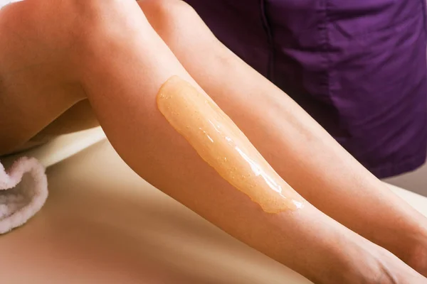sugar paste on the skin of the leg, hair removal procedure with paste. cosmetic procedure. Depilation procedure. hair removal. Details of epilation process