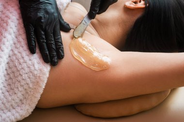 Siyah eldivenli kozmetik uzmanı koltuk altı tüy dökme prosedürünü uyguluyor. Epilasyon prosedürleri. Yakın plan saç kesimi. Epilasyon sürecinin ayrıntıları