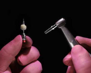 Diş sağlığı ve diş sağlığı kliniklerinde el aletleri ve diş implantı prosedürlerinde kullanılır..