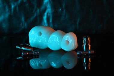 Diş hekimliğinde çene cerrahisi kullanan çeneler için tam alt ve üst çene protezi. Dörde karşı dört protez ve protez protez. Diş implantı tedavisi.