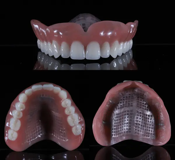 Diş muayenehanemde, diş tedavisinde kullanılan tam kemerli protez tamamen üst çenelerde. Üst çene tam protez.