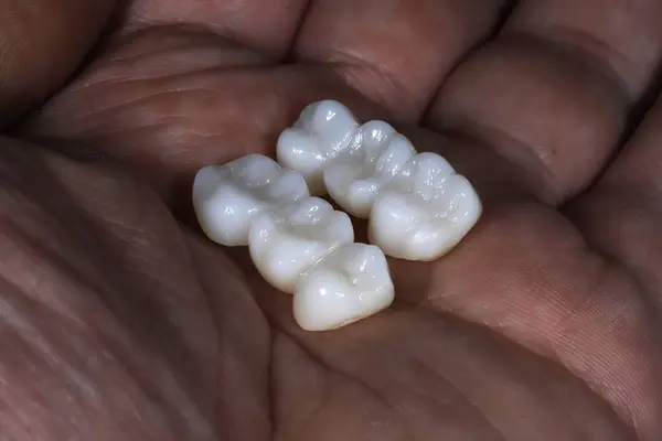 Zirkonyum köprü kaplama tedavisi ve diş estetik dişlerinde kullanılan gülümseme tasarımı tedavisi. Gülümse makyaj..