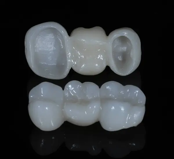 Köprü kaplaması protez tedavisi diş estetik dişlerinde eksik diş için. Zirkonyum porselen köprü tedavisi ve E-max porselen diş kaplaması.