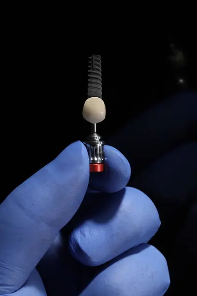 Diş implantı ameliyatında bir diş teknisyeni tarafından laboratuvarda üretilen implantlar için tek diş protezi. E-max ve zirkon altyapısı ile implant destekli diş protezi.