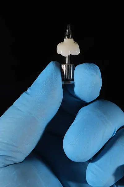 Porselen E-Max ya da zirkonyum protez tedavisi, diş cerrahisi yoluyla kemik yerleştirilmiş diş implantları tarafından destekleniyor. Gülümse tasarım tedavisi ve gülümseme makyajı.