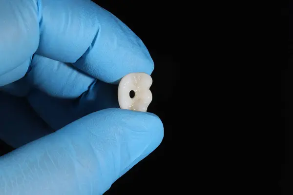 Porselen E-Max ya da zirkonyum protez tedavisi, diş cerrahisi yoluyla kemik yerleştirilmiş diş implantları tarafından destekleniyor. Gülümse tasarım tedavisi ve gülümseme makyajı.