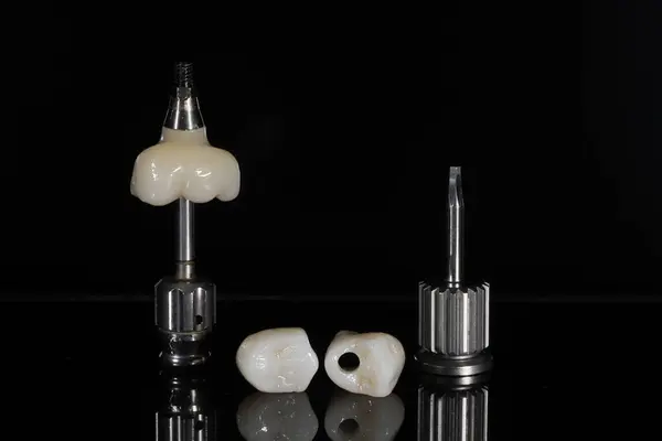 Çiğneme işlevinin yenilenmesi ve çenedeki eksik dişlerin yerine titanyum implant tedavisi ile diş kemerinin tamamlanması