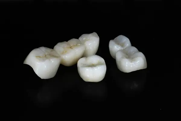 E-max veya zirkon cam seramik porselen kaplama kaplama tedavisi ve diş dökülme vakalarında diş tedavisinde kullanılan implant destekli taç tedavisi. Gülümse tasarımı.