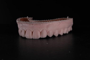 Diş tasarımı estetik olarak bilgisayar ortamında dijital olarak yaratıldı ve üretildi, modelleme çalışmaları ve diş tebessümü tasarımı. Gülümse makyaj..