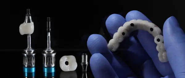 Diş ve çene cerrahisinde elmacık kemiğine implantlar yerleştirilmiş ve hepsinde 4 tekniği kullanılarak tam kemerli diş protezi kullanılmıştır. önce sonra