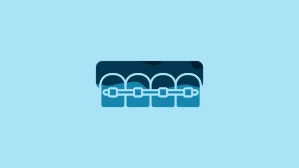 Blue Teeth Braces Icon Isolated Blue Background Alignment Bite Teeth — Stockvideo