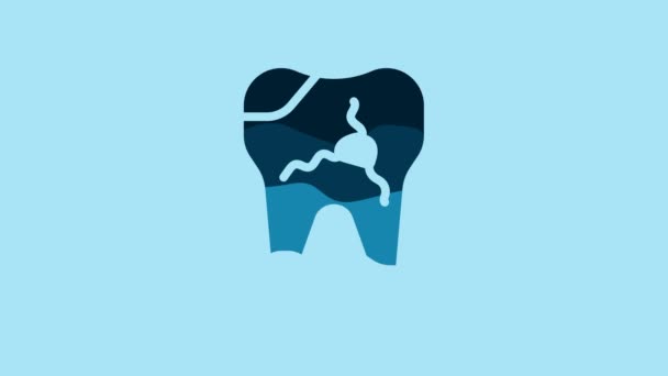Синій Зламаний Значок Зуба Ізольовано Синьому Фоні Піктограма Стоматологічної Проблеми — стокове відео