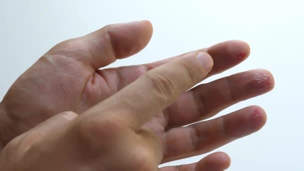 Κατεστραμμένο Αντρικό Χέρι Άνθρωπος Παλάμη Τραυματισμένα Δάχτυλα Γρατζουνισμένο Δέρμα Ματωμένο — Αρχείο Βίντεο