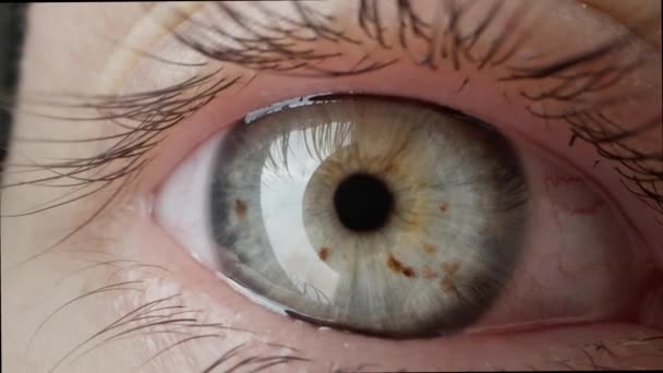Extreme Close Female Open Eye Freckles Iris Nevi — Stock Video