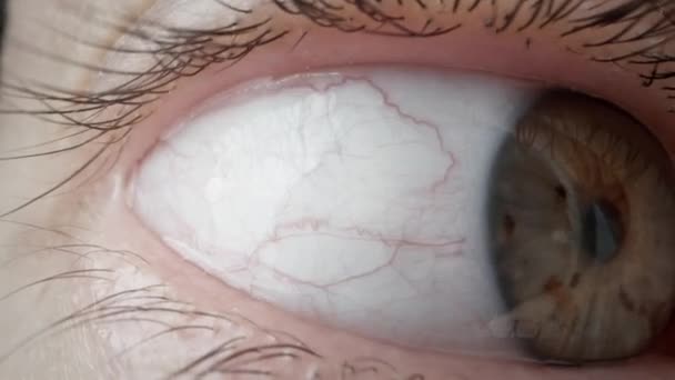 Primo Piano Estremo Occhio Aperto Femminile Con Lentiggini Iris Nevi — Video Stock
