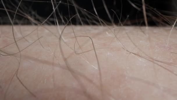 Vlasy Mužském Těle Extrémní Zblízka — Stock video