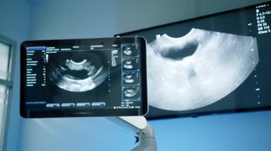 Kamera ultrason makinesinin monitörünü ve ekranda hareketlerini gösteriyor. Doktorlara evcil hayvanı neyin rahatsız ettiğini gösteriyor. Yüksek kalite 4k görüntü