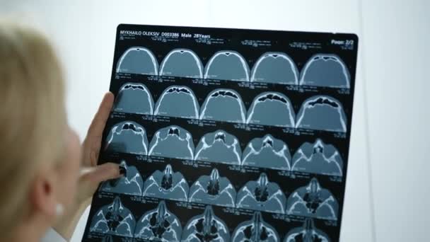 Toma Sobre Hombro Una Película Resonancia Magnética Médico Rubio Con — Vídeo de stock