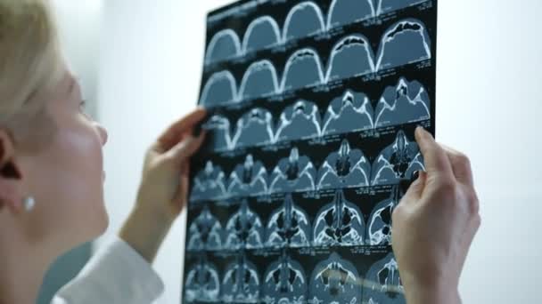 Primer Plano Resonancia Magnética Nasal Sinusal Examinado Fondo Por Lindo — Vídeo de stock