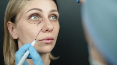 Kadın yüzünün cerrahi izlerinin olduğu omuz üstünden. Uzaktan bakan hastaya yaklaş. Doktor burun kıvrımlarına çizgiler çiziyor. Yüksek kalite 4k görüntü