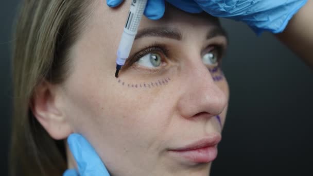 在眼部手术标记的过程中 为进行化妆品治疗而对女性面部进行近距离检查 手拿着手套 用笔尖上的皮肤标记来做记号 高质量的4K镜头 — 图库视频影像
