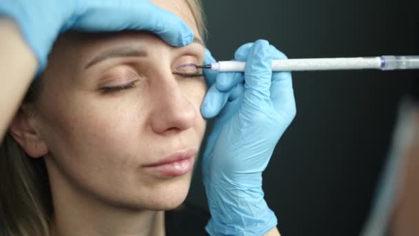 在年轻妇女的上眼睑上打上标记进行整形手术的过程 医生用皮肤标记笔画线 病人闭上眼睛 睁开眼睛 高质量的4K镜头 — 图库视频影像