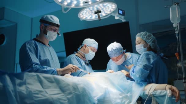 近代的な手術室で実行されるプラスチック手術手順のプロセス主導の手術室の光 モニター 外科チームは４人で構成される 高品質4K映像 — ストック動画