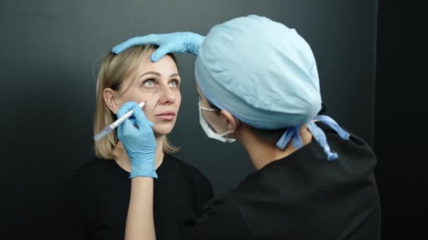 女医生肩膀上方的照片在女病人脸上画上了用于整容手术的记号 医生在眼部 太阳穴 鼻唇褶皱下画了线 高质量的4K镜头 — 图库视频影像