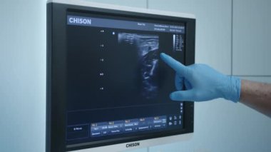 KYIV, UKRAINE - 6 Haziran 2023. Ameliyat noktalarında eldivenli bir erkek. Estetik cerrahi özel kliniğindeki modern tıbbi tesisler. Yüksek kalite 4k görüntü