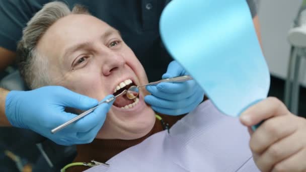 歯科鏡とスクレーパーを使用して歯科検査を行っている間 口が広く開いた灰色の髪を持つ男性中年患者 高品質の4K映像 — ストック動画