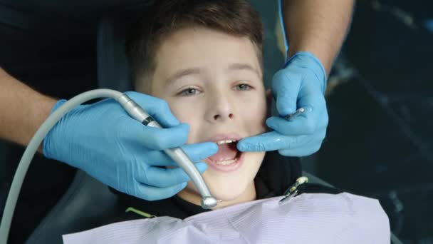 医療用手袋の歯科専門家は 使い捨てナプキンで小さな患者の口を開き 水スプレーで歯車を使用して水を噴霧します 高品質の4K映像 — ストック動画