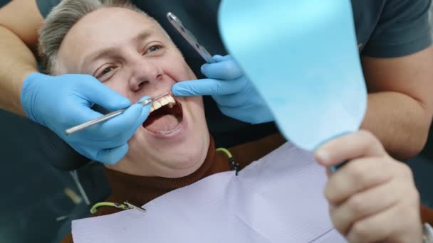 스크레이퍼와 치아를 만지는 장갑에 의사의 거울을 환자의 닫습니다 고품질 — 비디오