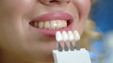 Dişi dişleri kapatın, diş implantı örnekleri açık ağzın yanında, tanınmayan kişi takma dişleri işaret ediyor, mavi arka plan, klinik. Yüksek kalite 4k görüntü
