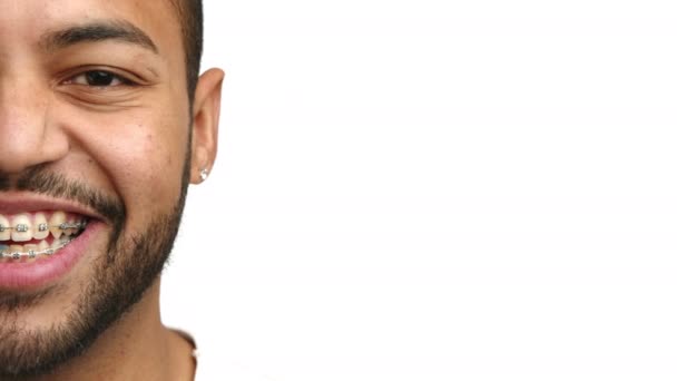Retrato Meia Cara Mostra Jovem Homem Cativante Sorriso Com Aparelho — Vídeo de Stock