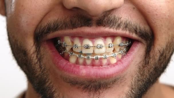 近距离观察一个快乐的非裔美国人的微笑 他的支撑充分展示 反映了一种自信和积极向上的感觉 重点是牙齿健康和幸福 8K照相机 — 图库视频影像