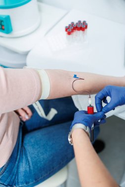 Medical procedure. Taking blood from a vein into a test tube. Sterile blood collection